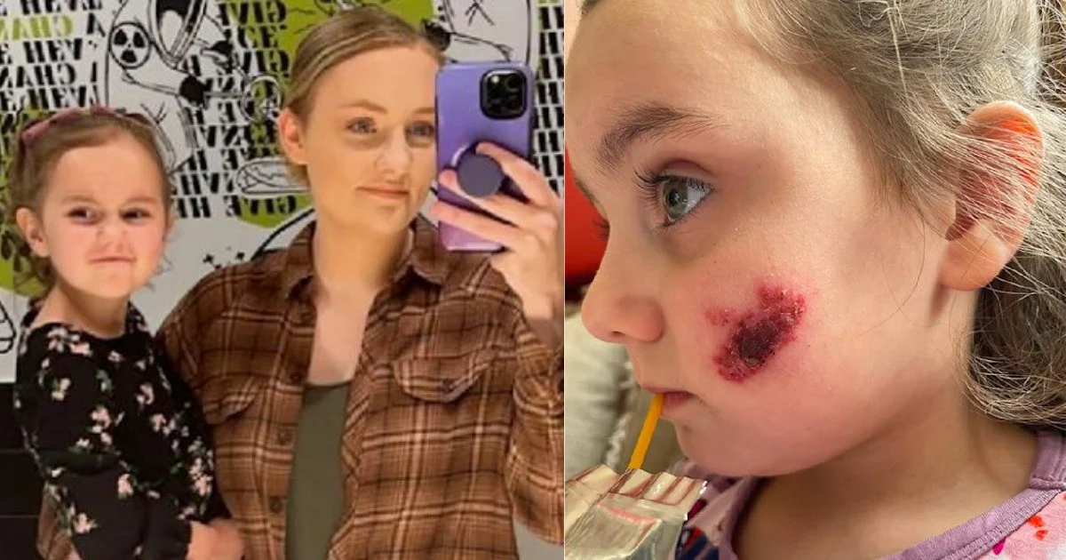 Το αθώο φιλί της μαμάς της, έστειλε 4χρονη στο νοσοκομείο με σοβαρή λοίμωξη!